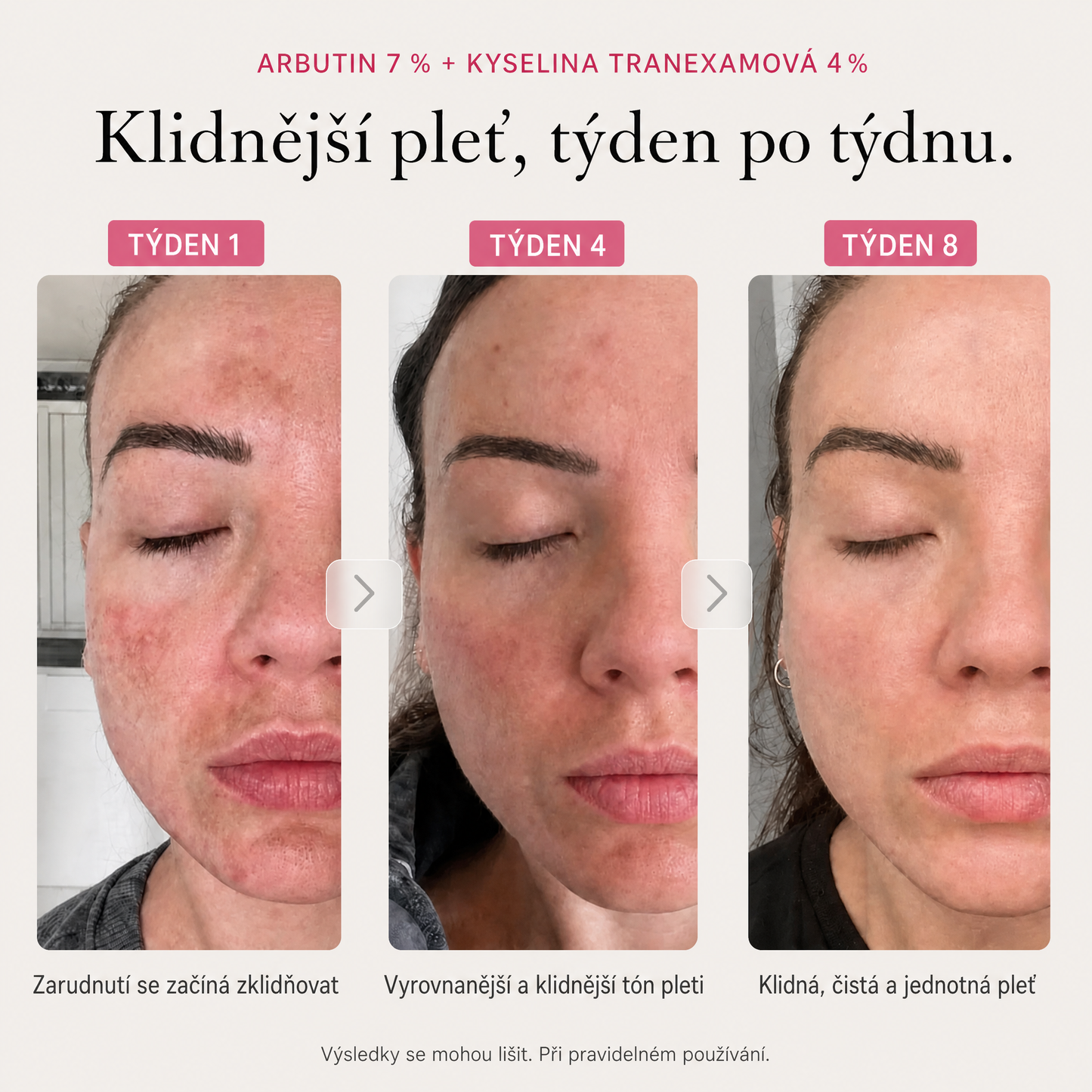Rozjasňující krém Millie Han – Arbutin 7 % + TXA 4 %
