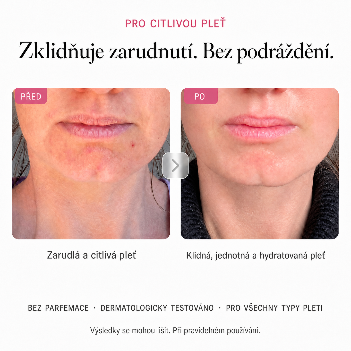 Rozjasňující krém Millie Han – Arbutin 7 % + TXA 4 %
