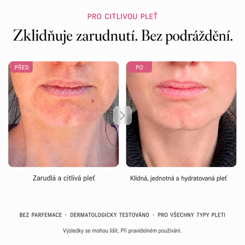 Rozjasňující krém Millie Han – Arbutin 7 % + TXA 4 %