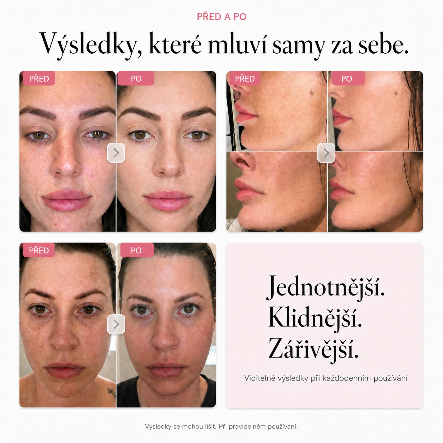 Rozjasňující krém Millie Han – Arbutin 7 % + TXA 4 %