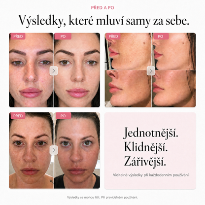 Rozjasňující krém Millie Han – Arbutin 7 % + TXA 4 %