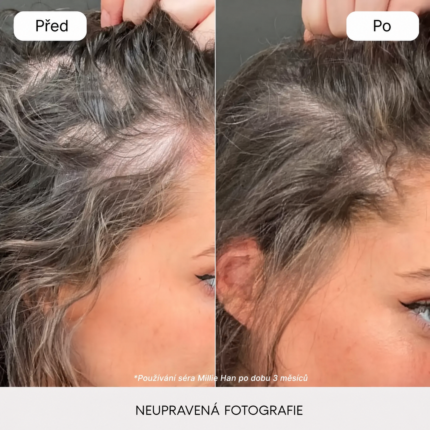 Před a po 3 měsících používání séra Millie Han – neupravená fotografie